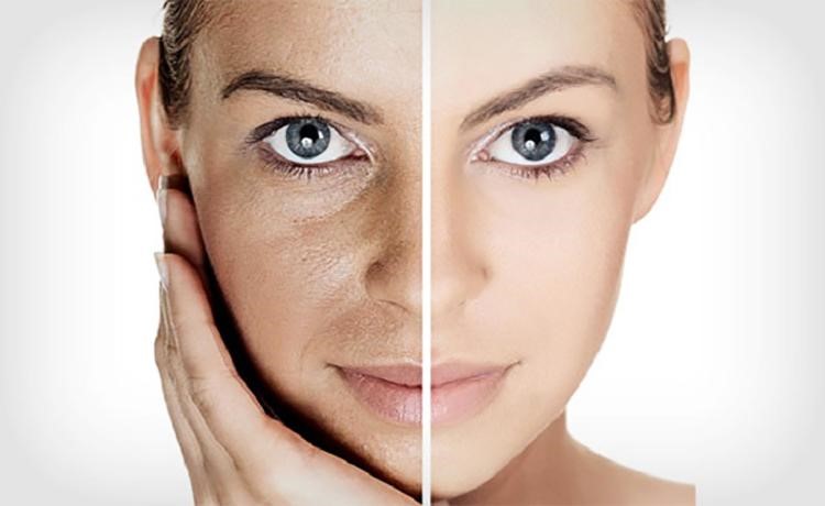 لایه برداری پوست چه فایده ای دارد؟