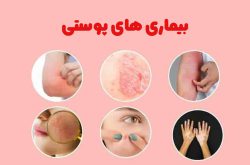 بیماری های پوستی رایج