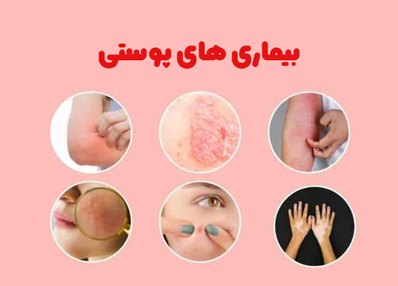 عکس بثورات پوستی + عکس بیماری های پوستی + عکس زخم های پوستی
