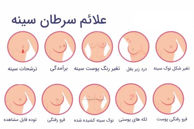 علائم هشدار دهنده اولیه و علائم تهاجمی سرطان سینه چیست ؟