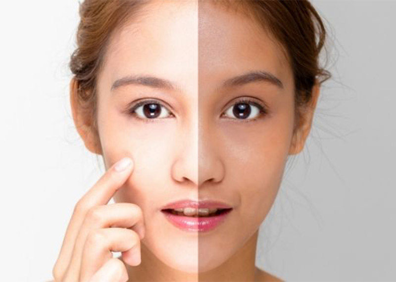 خرید بهترین کرم روشن کننده قوی
