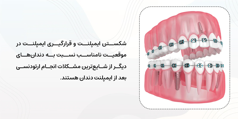 مشکلات انجام ارتودنسی بعد از کاشت ایمپلنت