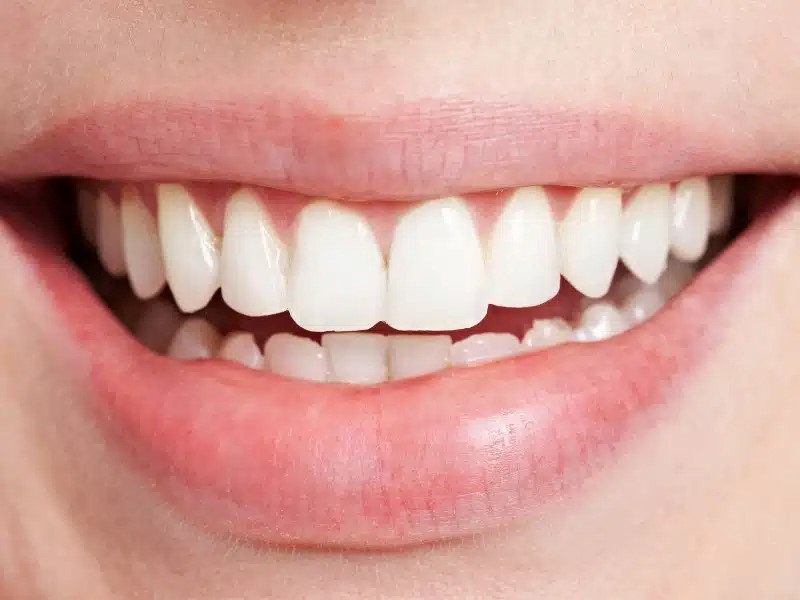 بهترین مواد طبیعی برای سفید کردن دندانها